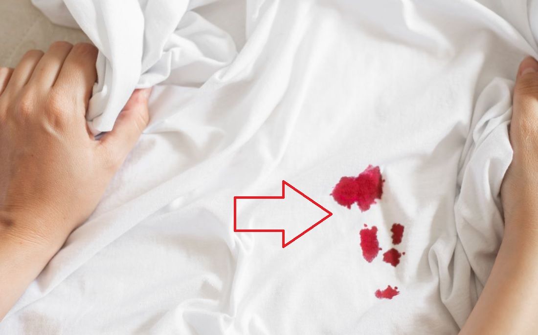 3 cara efektif menghilangkan noda darah di sprei dengan kuah bakso